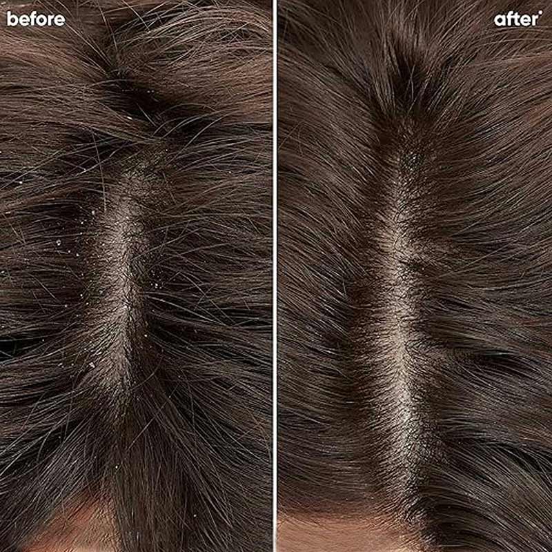 Matrix Biolage Professional Scalppure Anti-Dandruff Shampoo (200ml)