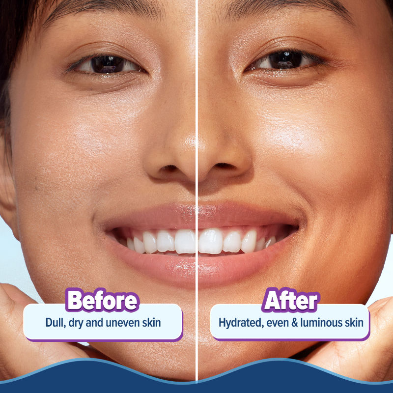 Aqualogica Illuminate+ Hydra Gel Moisturizer - Alpha Arbutin (200g)