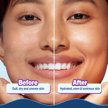 Aqualogica Illuminate+ Hydra Gel Moisturizer - Alpha Arbutin (200g)