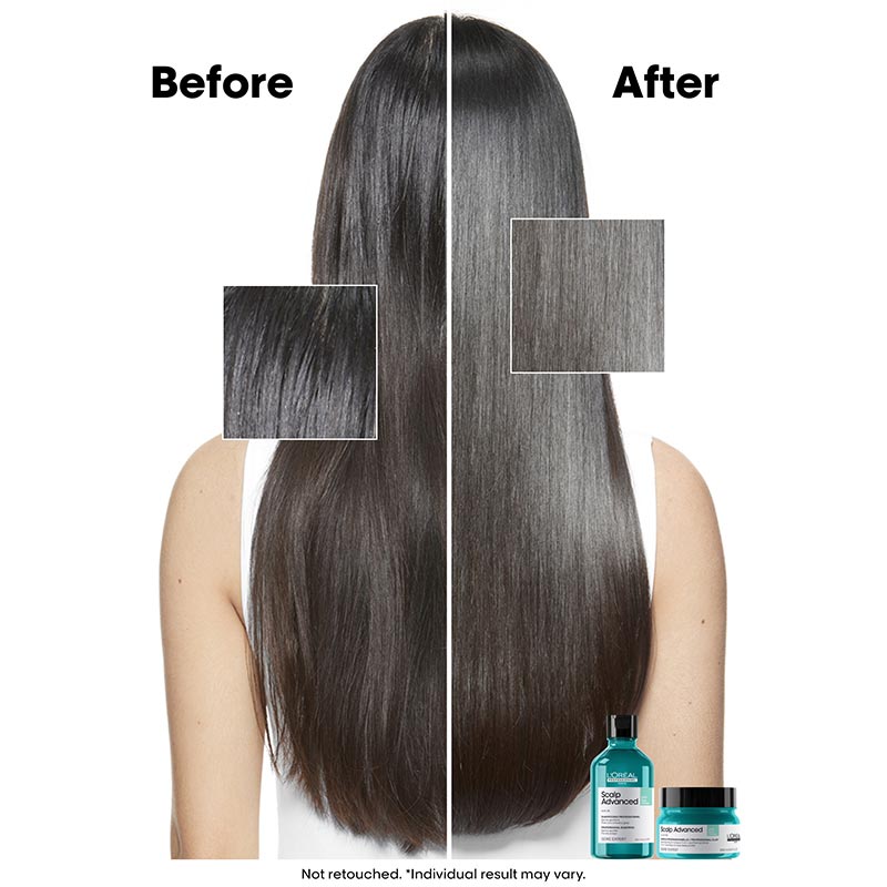 L'Oréal Professionnel Scalp Advanced Anti-Oiliness 2-In-1 Shampoo & Mask Deep Purifier Clay for Very Oily Scalp (250ml)