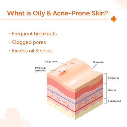 The Derma Co 1% Hyaluronic Sunscreen Oil-Free Gel with SPF 50 PA++++ for Oily & Acne-Prone Skin (50g)