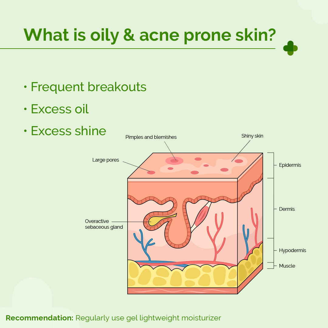 The Derma Co 5% Nia-Ceramide Mattifying Moisturizer (100g) - Oily & Acne-Prone Skin